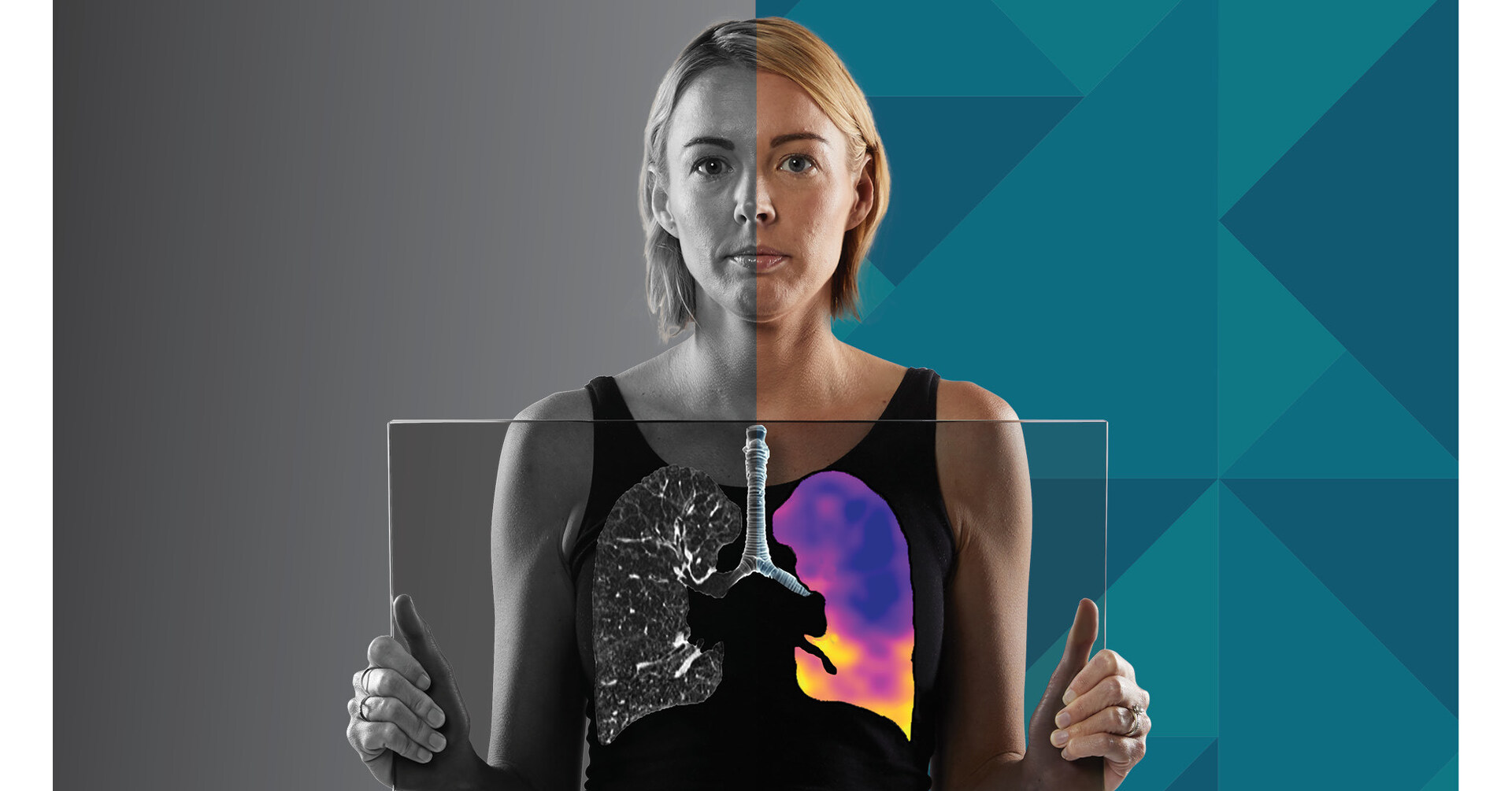 4DMedical erhält TGA-Zulassung für CT:VQ™ und bringt damit kontrastmittelfreie Ventilations-/Perfusionsbildgebung nach Australien