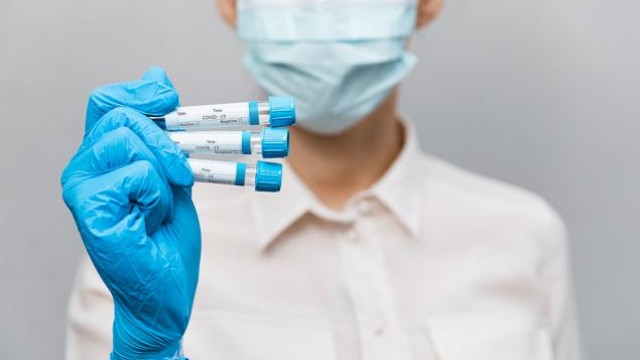 BD's (BDX) FDA-Approved Test to Offer Wider Testing Access