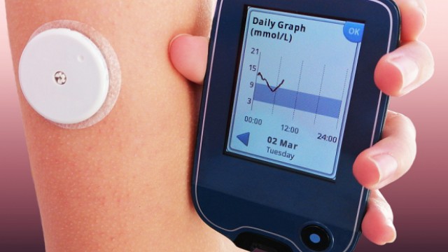DexCom (DXCM) Declines on Potential Competition for Stelo (revised)