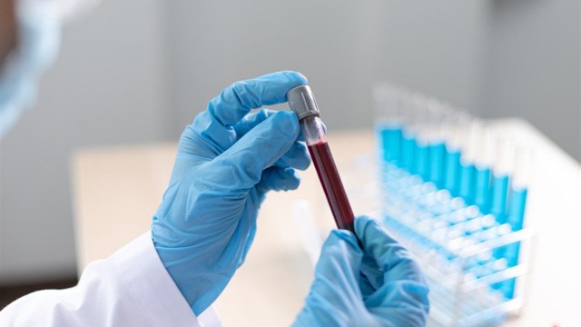 Geron Corporation: FDA Approval Fuels Stock Price Surge