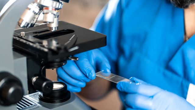 Artikelbillede til Her er grunden til, at Cellect Biotechnology-aktierne steg 50 % på mandag