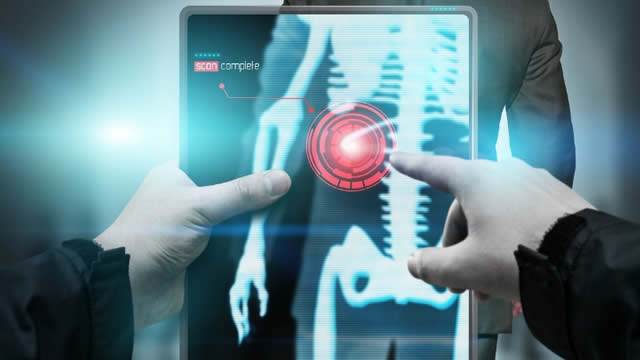 Hyperfine's (HYPR) Swoop System Gets New FDA-Cleared Software