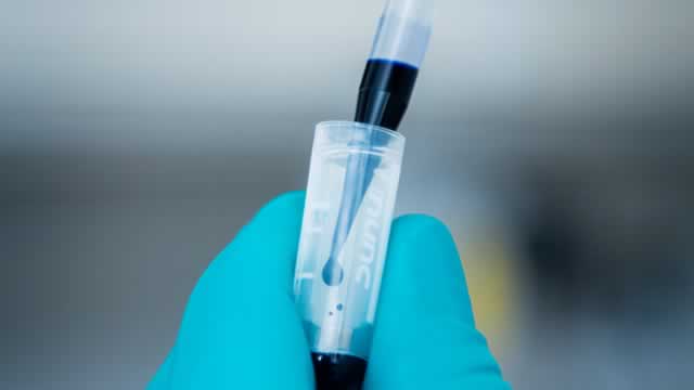 Is It Time to Buy the Dip in Novo Nordisk Stock?