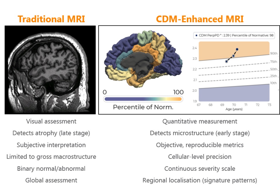 Oxford Brain Diagnostics Advances Vision for Measuring Brain Health and Neurodegenerative Disease with Five New Studies at AAIC 2026