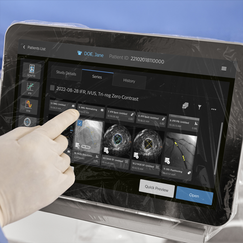 Philips highlights advances in imaging and physiology to support complex PCI at EuroPCR 2026