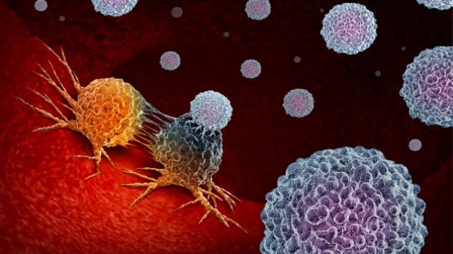Profound Medical (PROF) Adds AI to Prostate Cancer Treatment