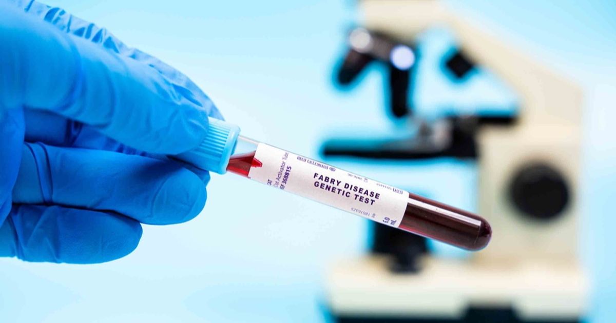 Protalix wins EU panel backing for expanded dosing of Fabry disease drug