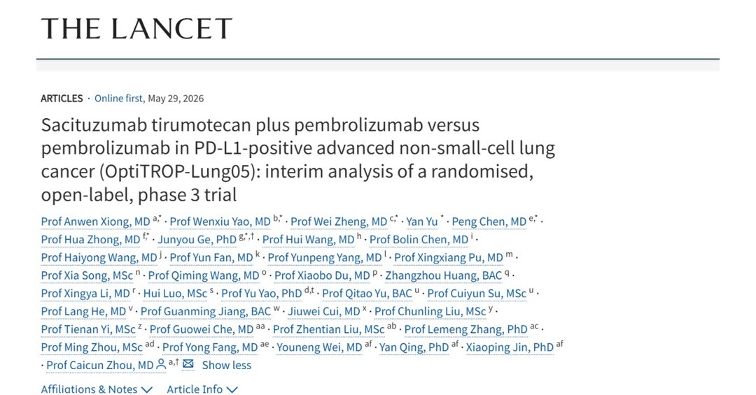 Sacituzumab Tirumotecan (sac-TMT) in Combination with Pembrolizumab for First-Line Treatment of PD-L1-Positive NSCLC Published in The Lancet