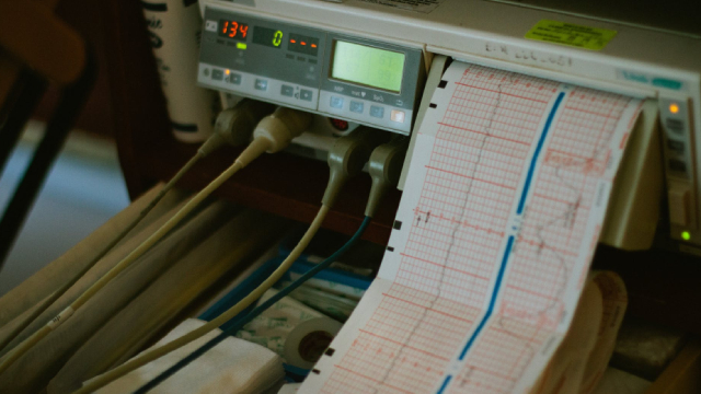 Foto von Savage price target cut, but here's why Ceres Power is still a 'buy'