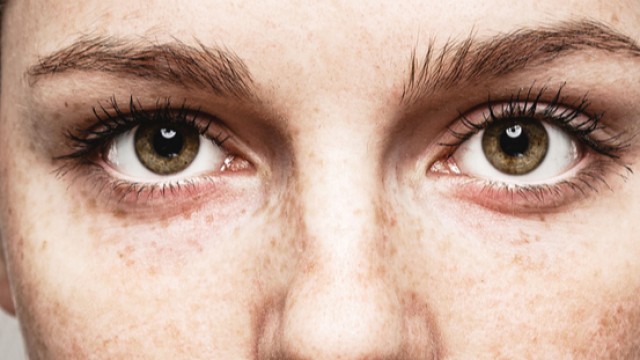 Skye Bioscience to discontinue development of eye disease treatment