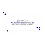 TEZSPIRE approved in the US for chronic rhinosinusitis with nasal polyps
