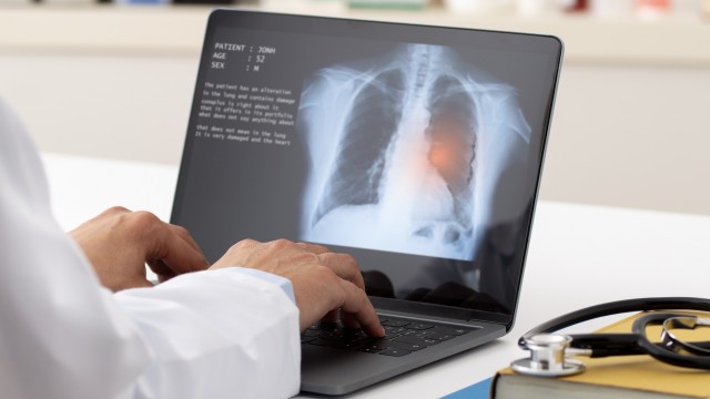 Theralase eyes Phase 1a trial for lung cancer therapy after preclinical success