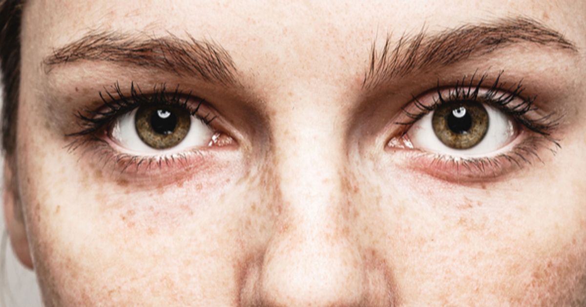 Viridian Therapeutics shares fall over 30% after trial data disappoints