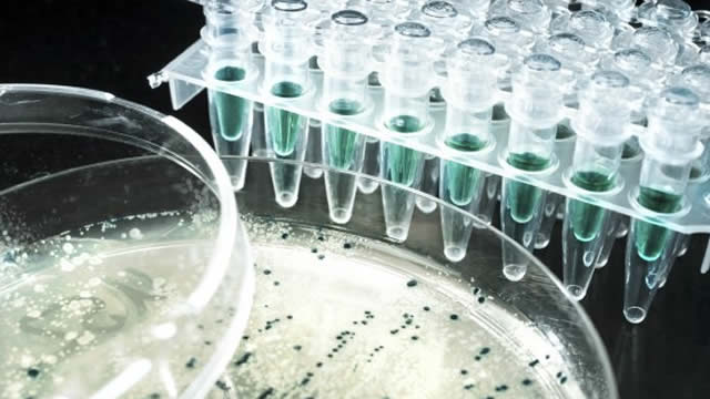 Foto von Why Gilead Sciences (GILD) is a Top Value Stock for the Long-Term