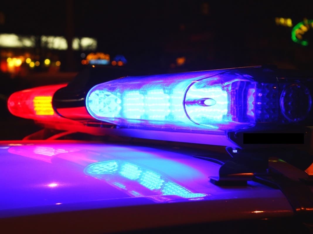 Woman Left With 'Significant Facial Injuries' In Bloody Palos Verdes Assault: PVEPD