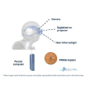ALMDP.PA's stock peer is ALPIX.PA (Pixium Vision S.A.)
